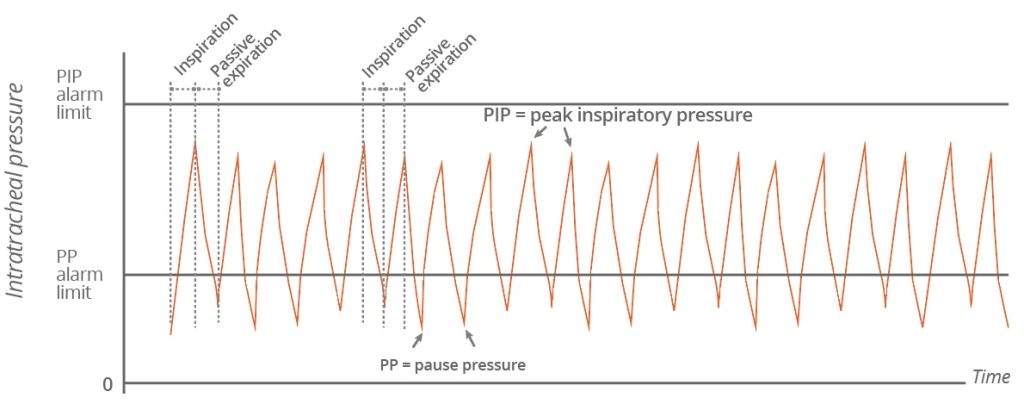 Jet Mode intratracheal pressure: typical sequence of Jet breathing cycles is shown.