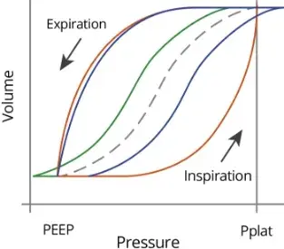 Idealized PV loops (the enclosed area of each loop is the dissipated energy) during PCV (red line), VCV (blue line) and FCV® (blue line during inspiration, green line during expiration)