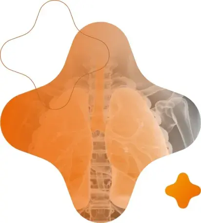 Patient ventilation with minimal impact and maximal control.